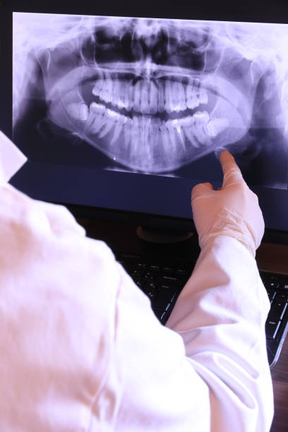 Best Emergency Root Canal Treatment in Layton, UT