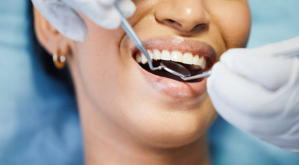 Best Emergency Dental Care for Broken or Chipped Teeth in Layton, UT