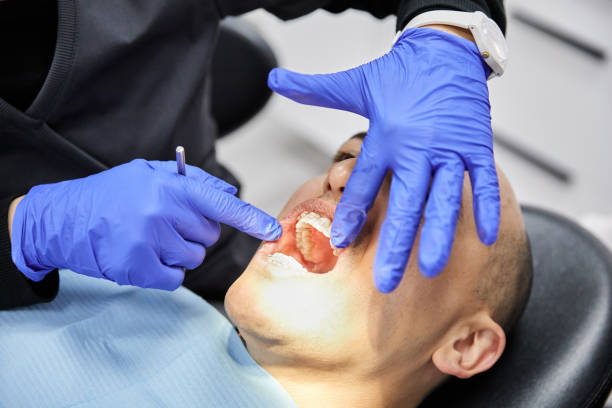 Best Emergency Tooth Extraction in Layton, UT